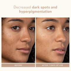 SHANI DARDEN Lactic Acid Serum application closeup demonstrates smooth, even skin prep