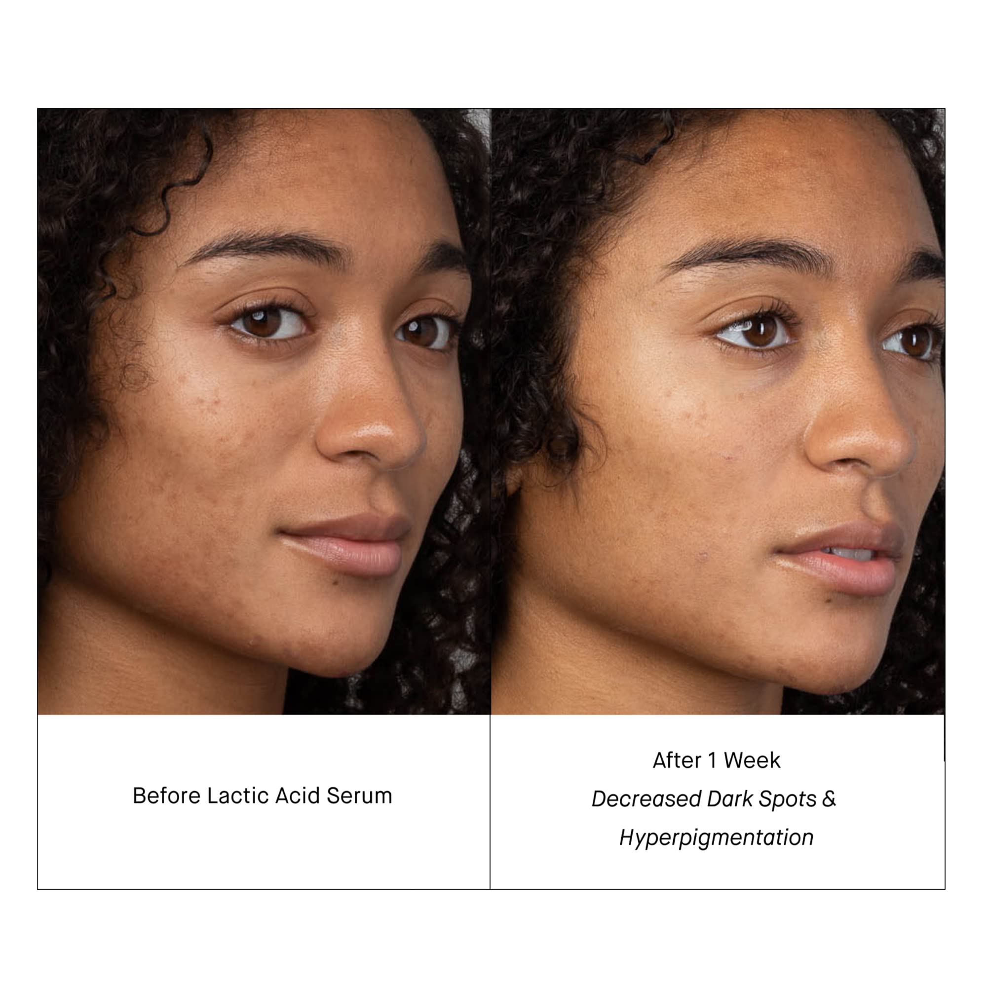 Closeup of Shani Darden Lactic Acid Serum pump for even application.