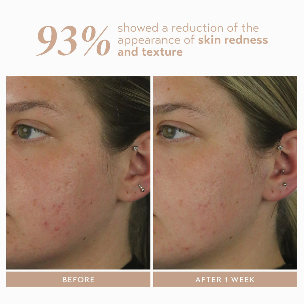 Evening routine scene with serum and moisturizer for refreshed skin after use