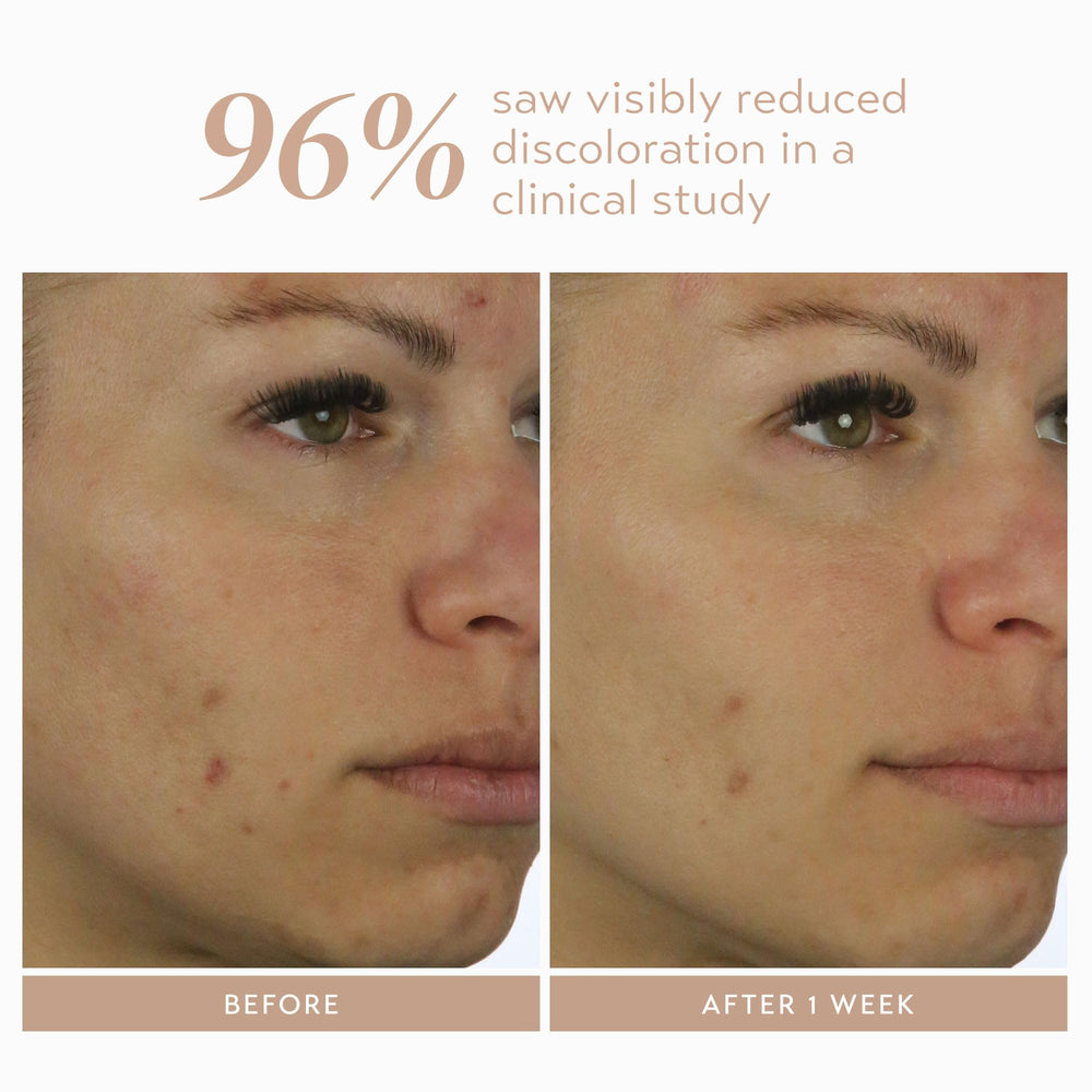 Moisturized skin after application showing soft, smooth finish