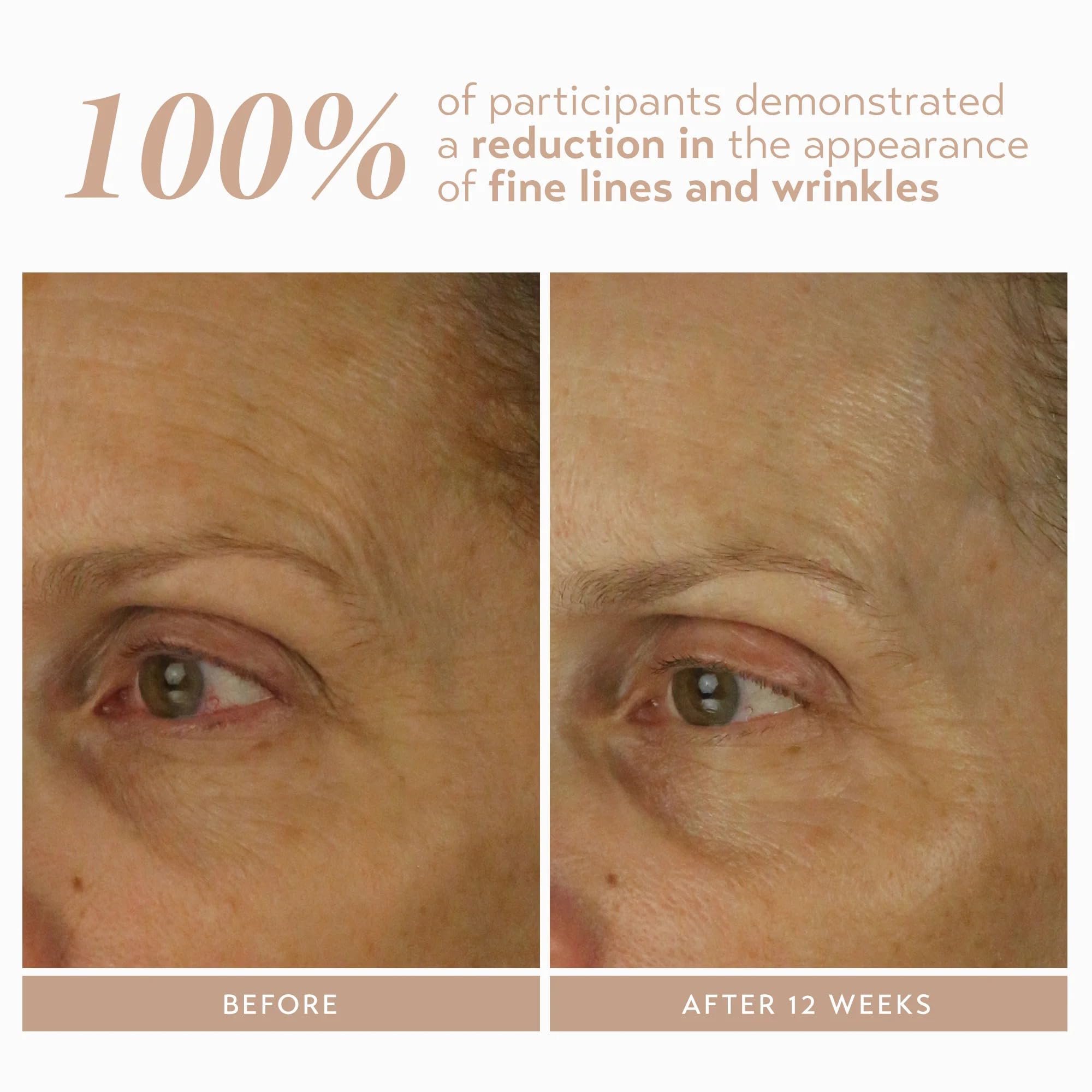 SHANI DARDEN Retinol Reform ingredients include niacinamide and ceramides for comfort