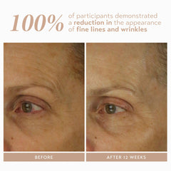SHANI DARDEN Retinol Reform ingredients include niacinamide and ceramides for comfort