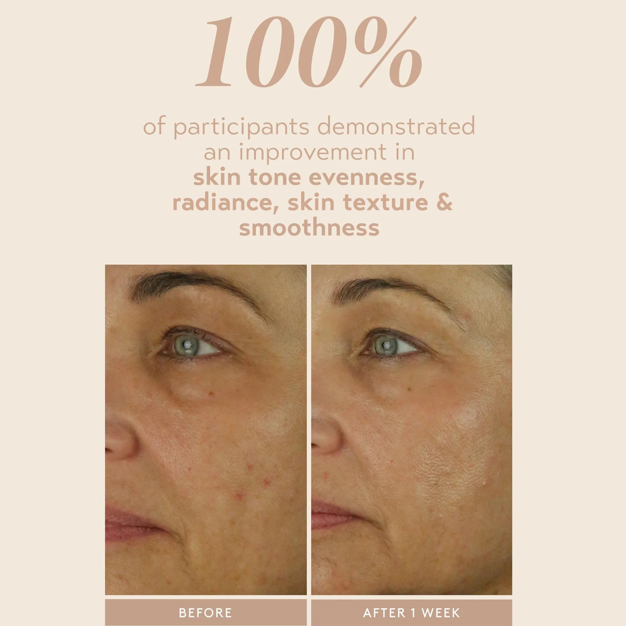 Niacinamide, ceramides, and aloe ingredients image suggests moisture-balanced support.