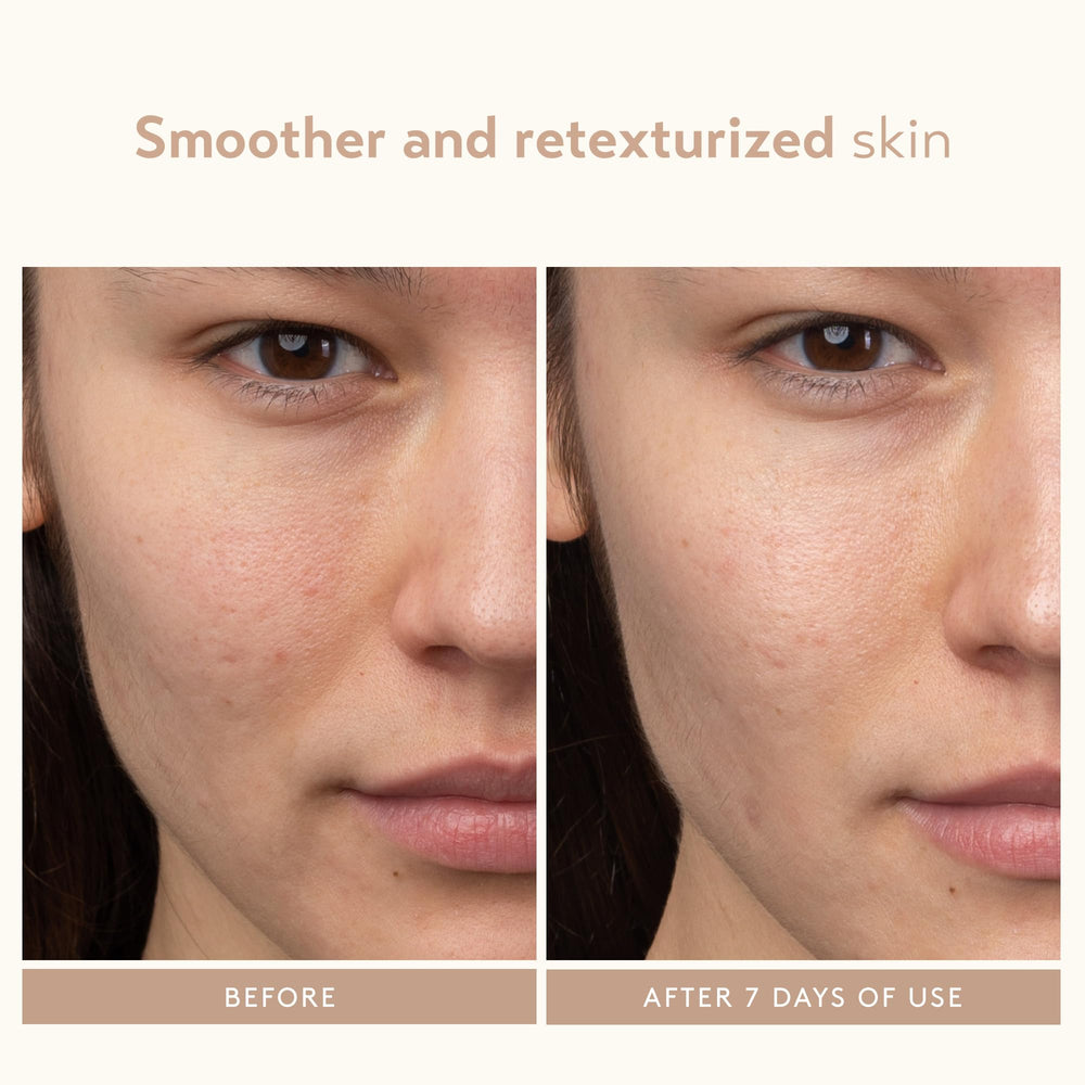 SHANI DARDEN Soothing Complex closeup emphasizes hydration from hyaluronic acid, aloe, and green tea
