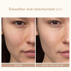 Travel-size packaging of SHANI DARDEN serum for on-the-go skincare routines.