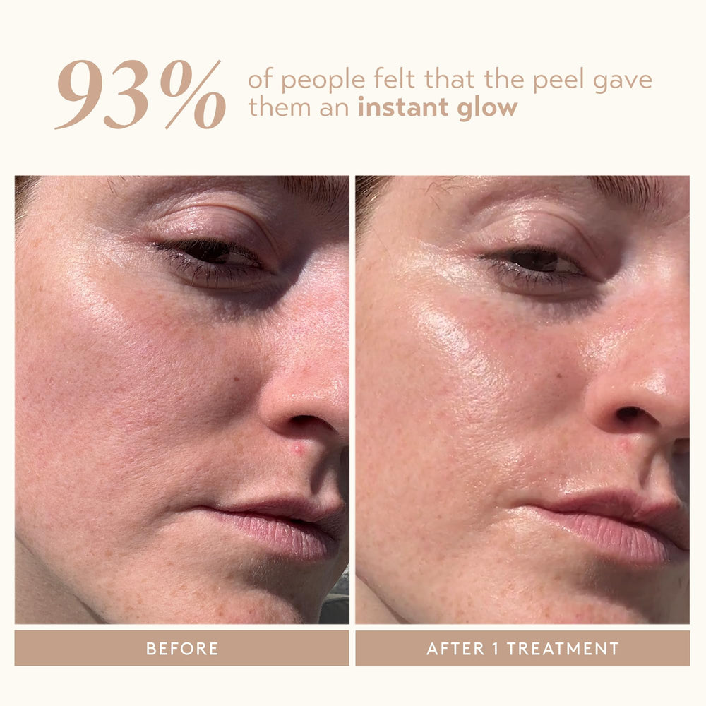 SHANI DARDEN Kaolin mask neutralizing after-peel residue for clearer-looking pores.