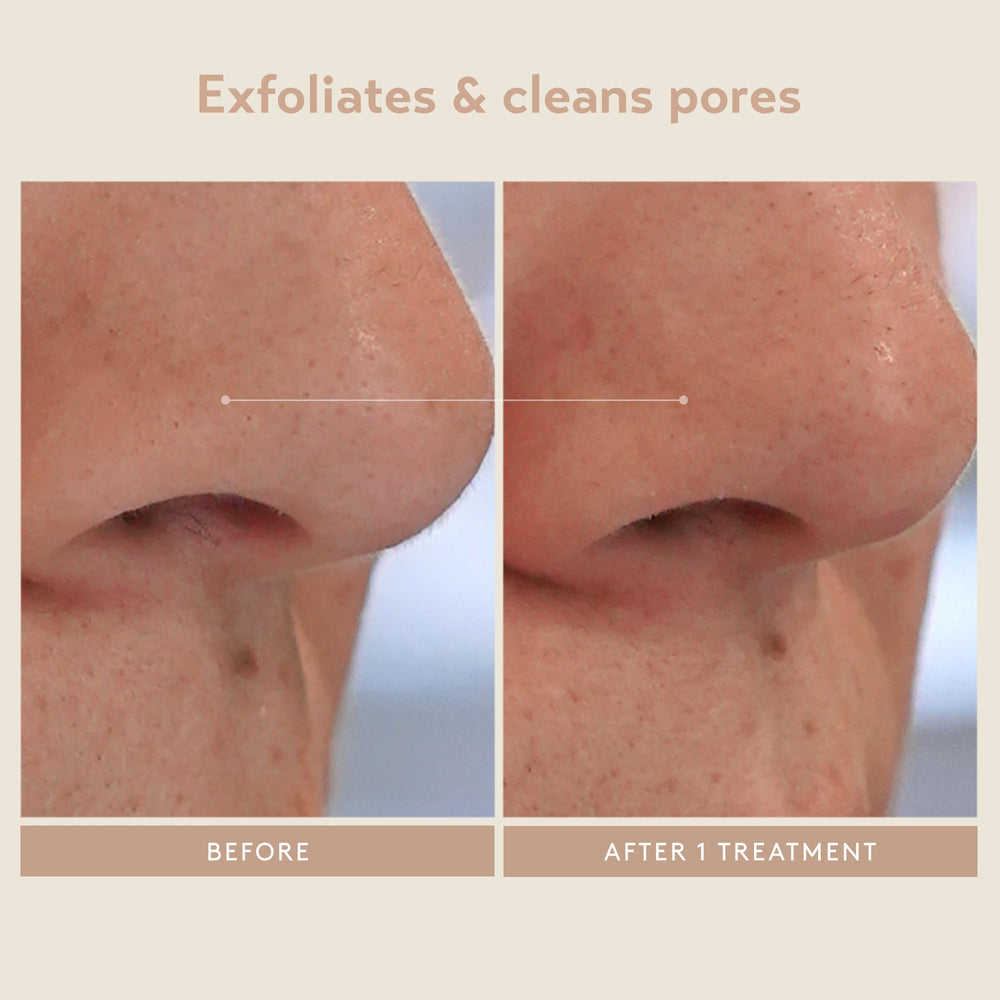 SHANI DARDEN travel-size kit ready for on-the-go skincare routines.