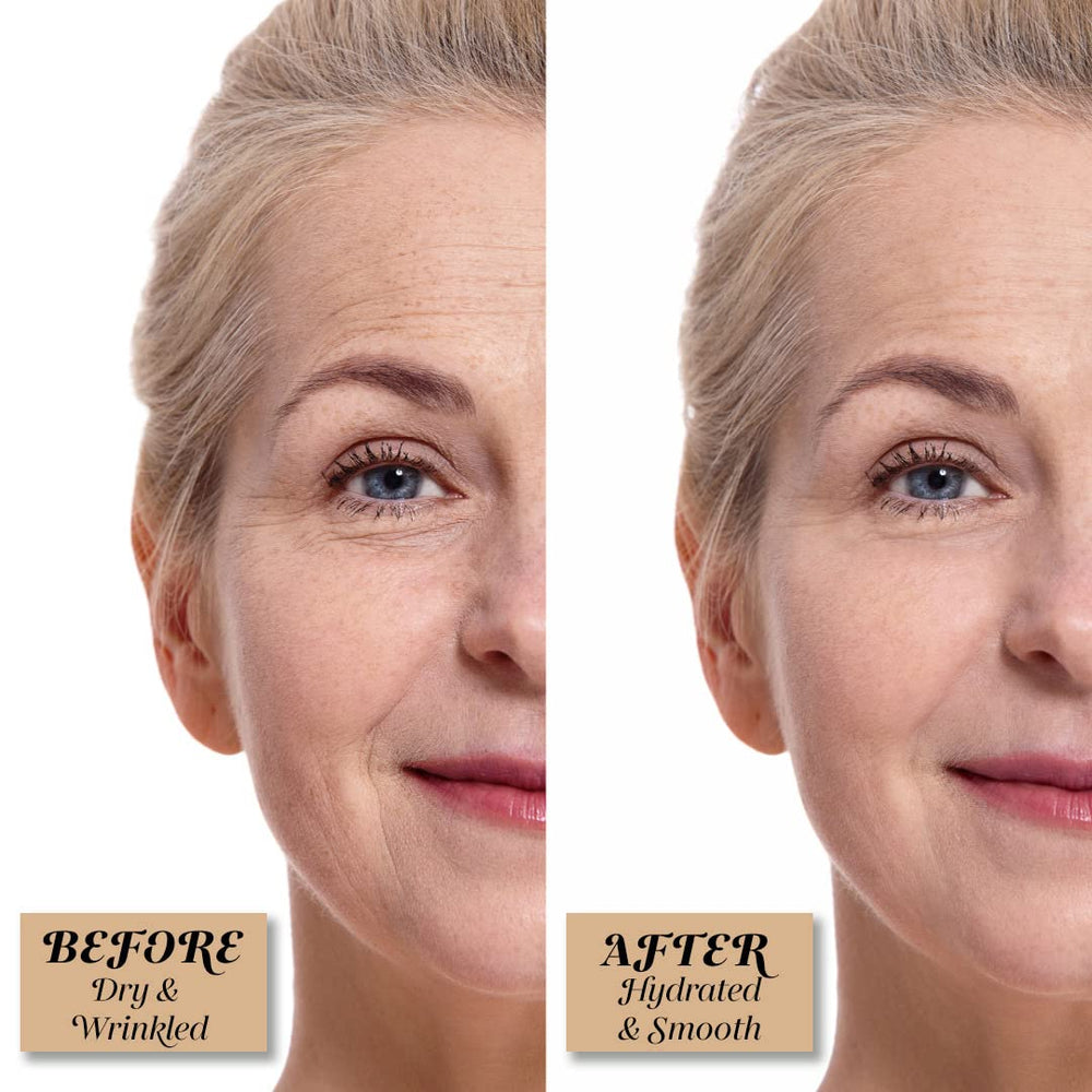 Shankara Ageless Serum hyaluronic-acid-note focusing on hydration support