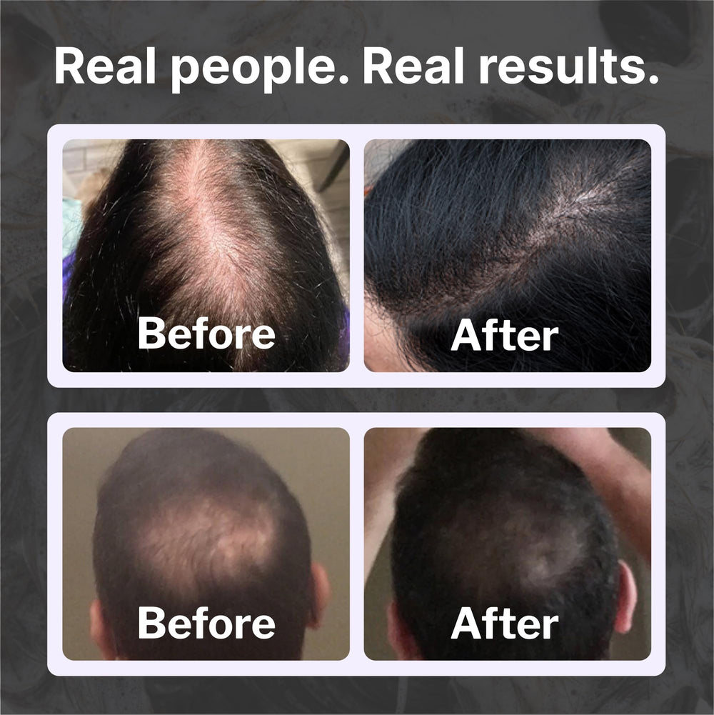Shapiro MD shampoo lather spreading through hair during wash