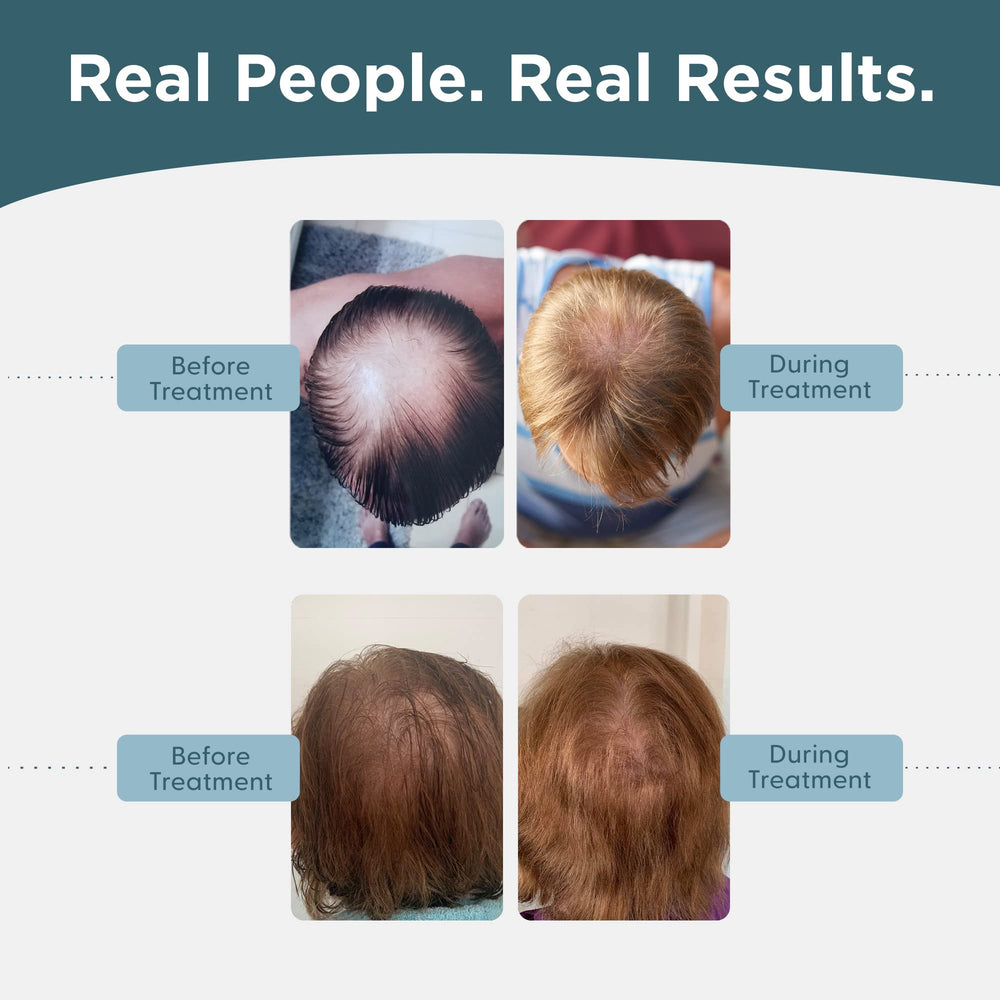 Step-by-step dropper technique for precise scalp application
