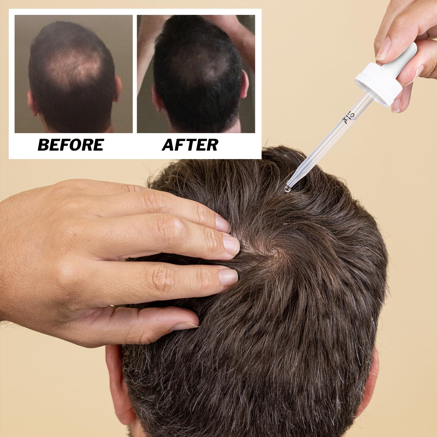 Shapiro MD Regrowth Kit packaging showcases the complete regimen.