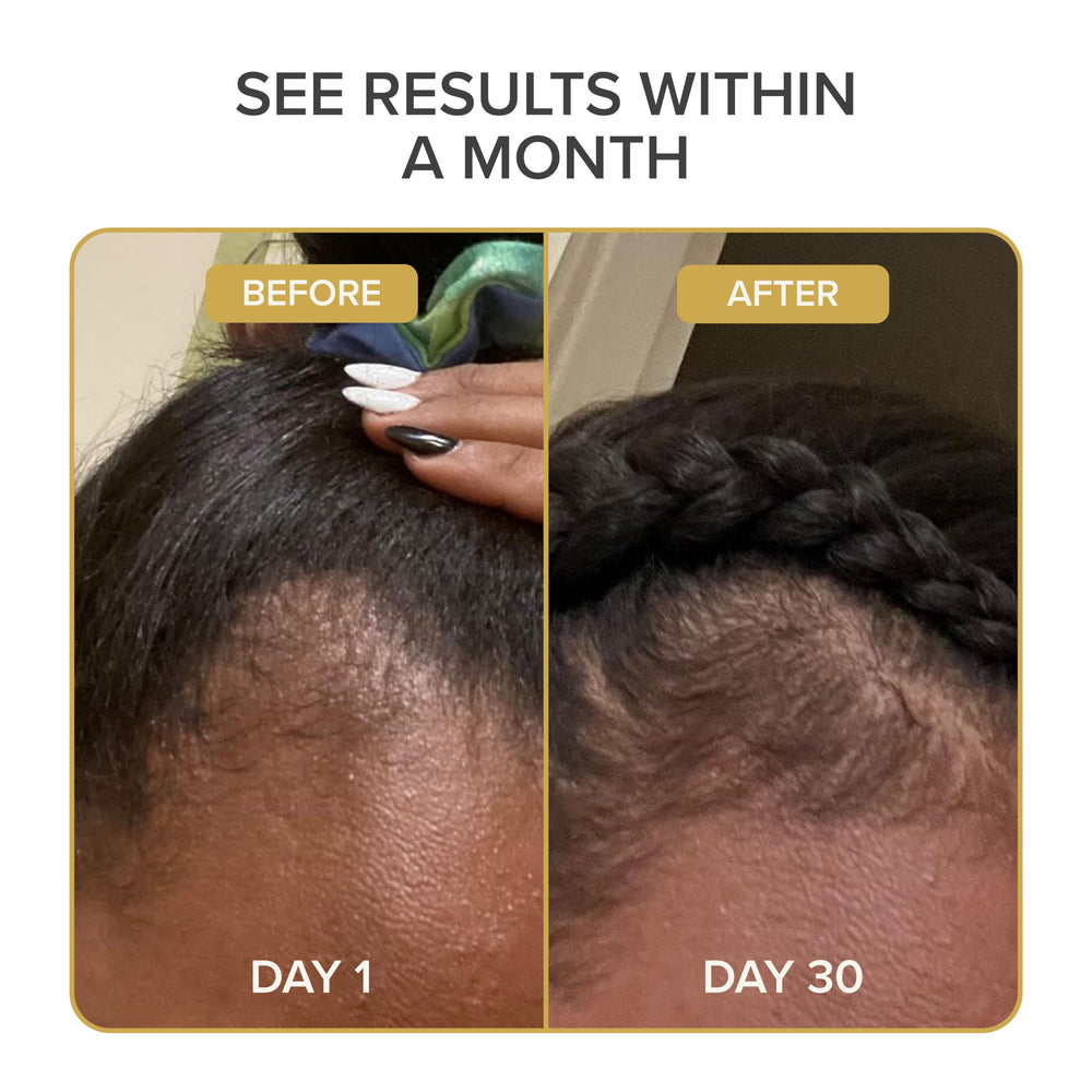 Shedavi Iconic vegan hair serum helps protect damaged strands and supports scalp vitality.