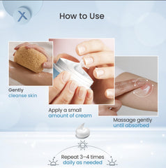 ShingleX Skin Cream application action demonstrates gentle daily use.