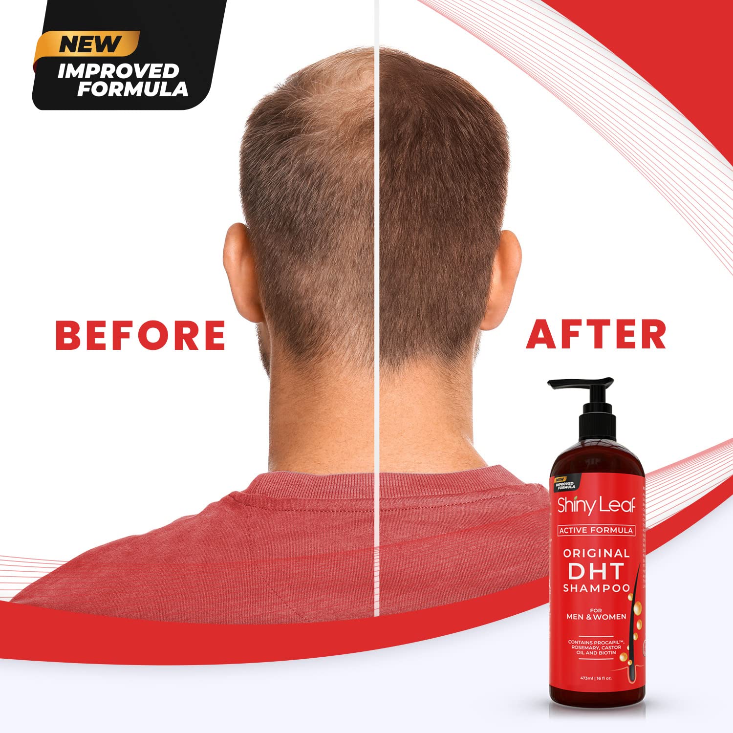 Shiny Leaf DHT Blocker Shampoo two-pack offers value for ongoing thinning hair care