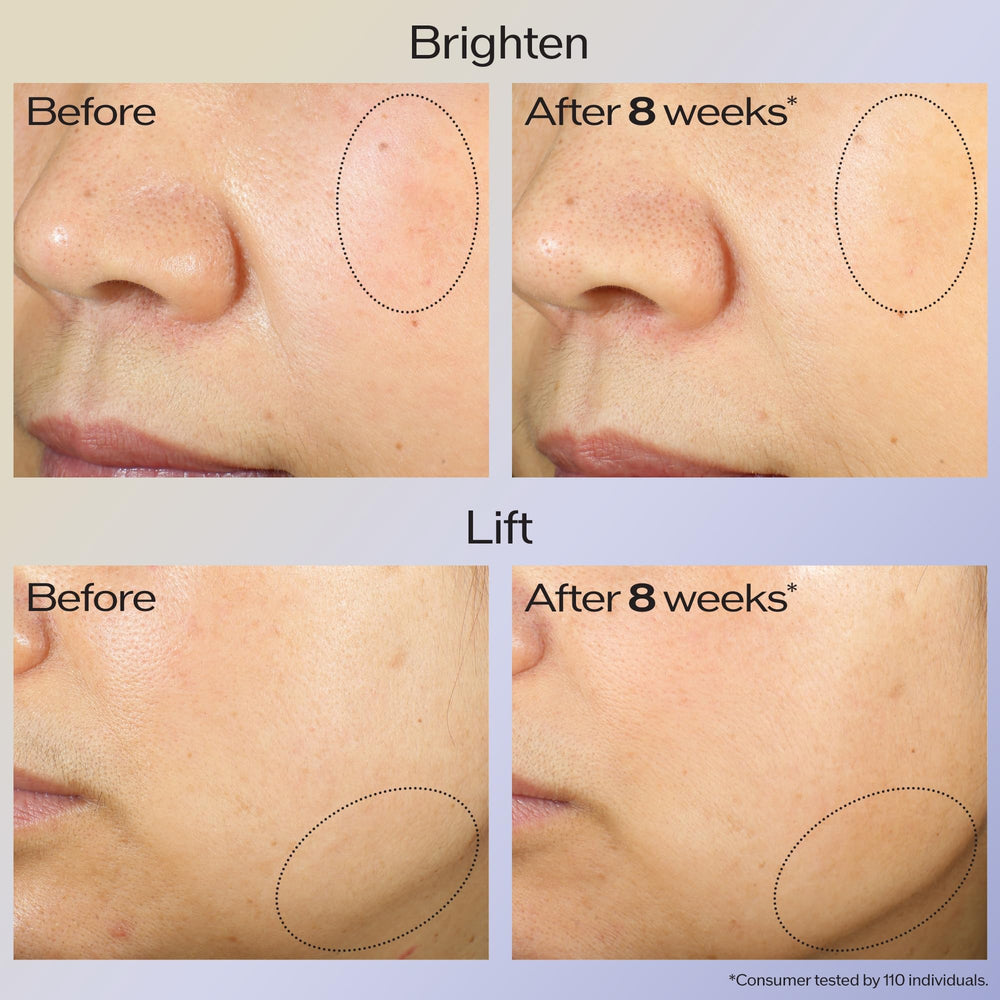 Shiseido Vital Perfection close-up shows even-toned look possible