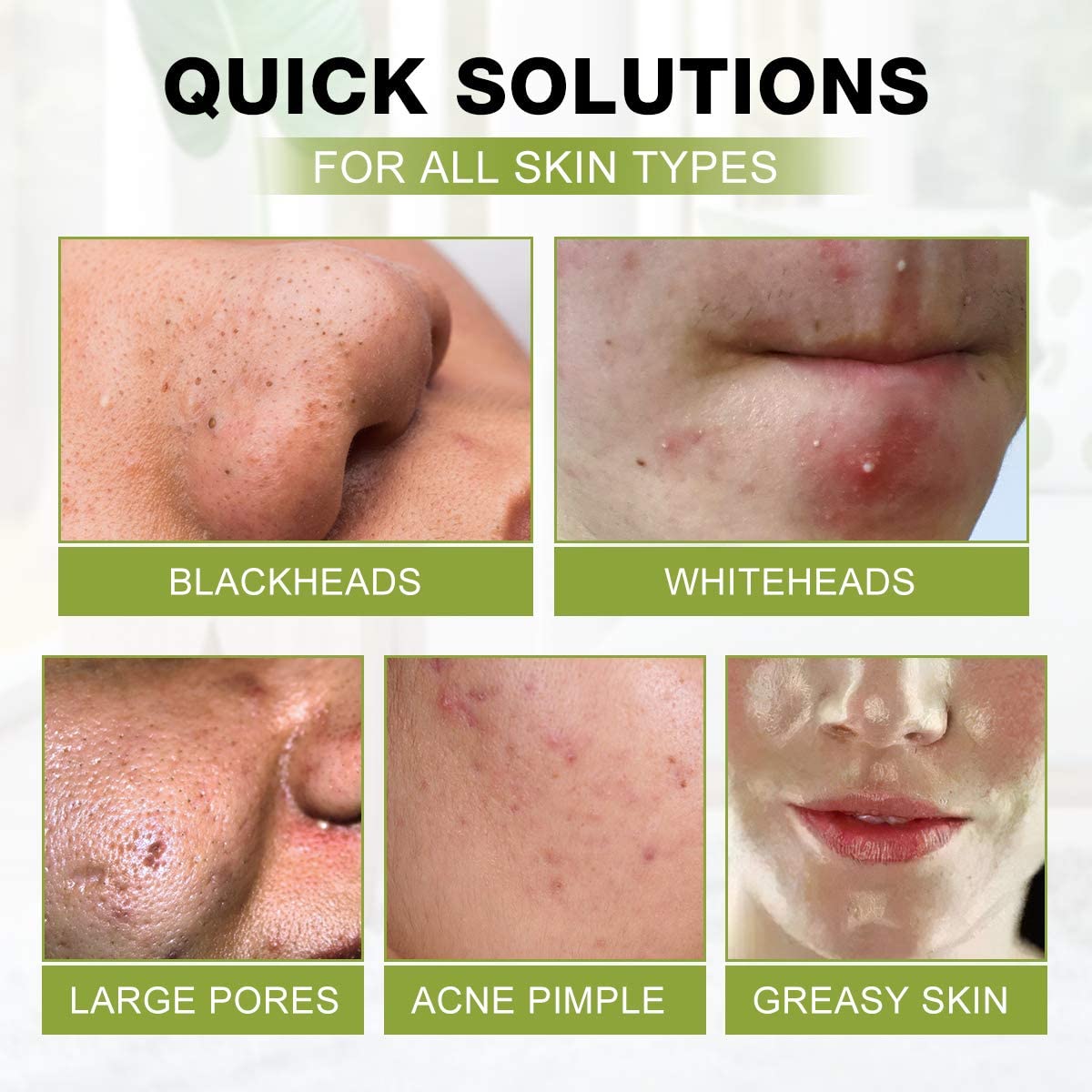 SHVYOG peel-off mask use for clean, refreshed-looking pores