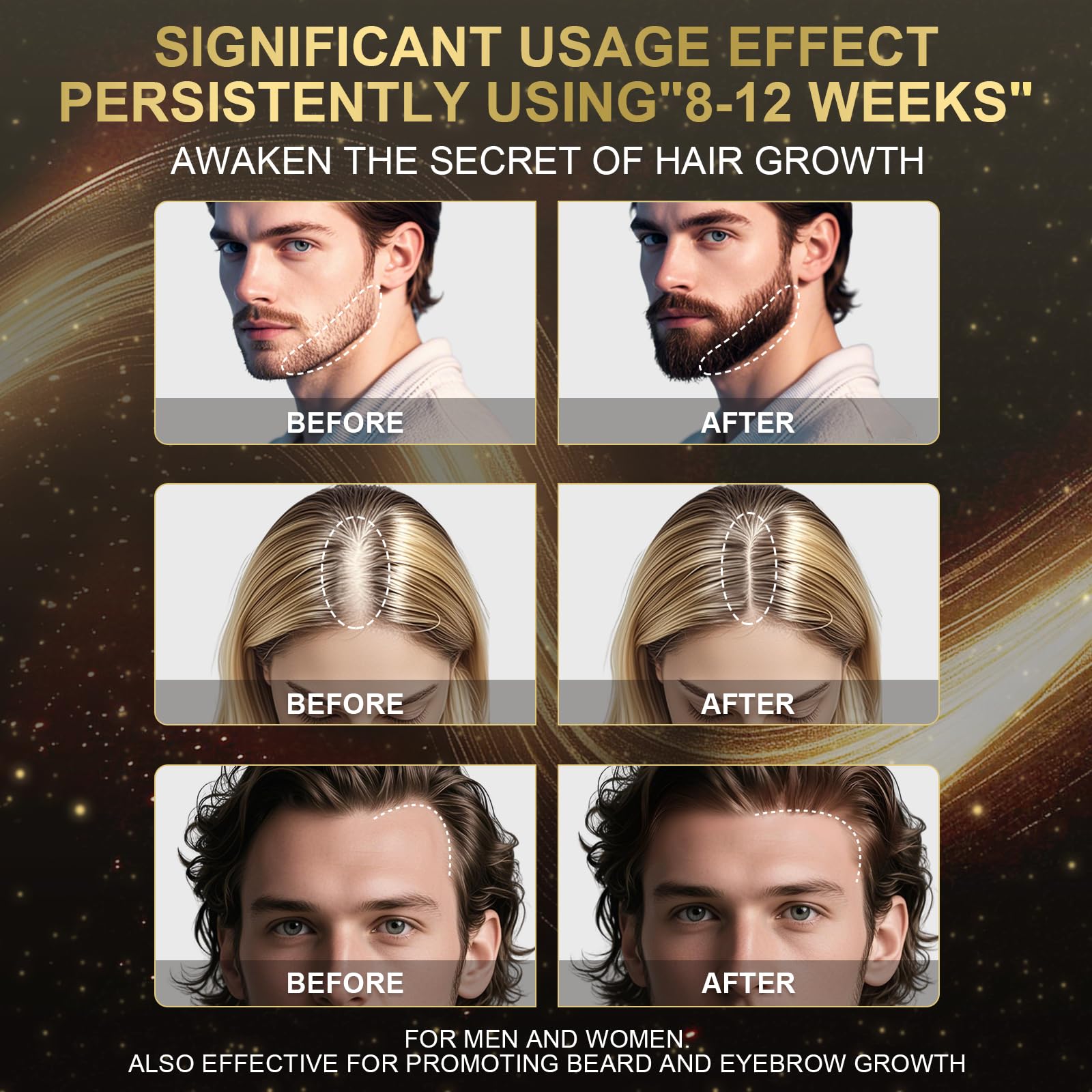 Sidinox minoxidil foam being applied to the scalp for easy daily use.
