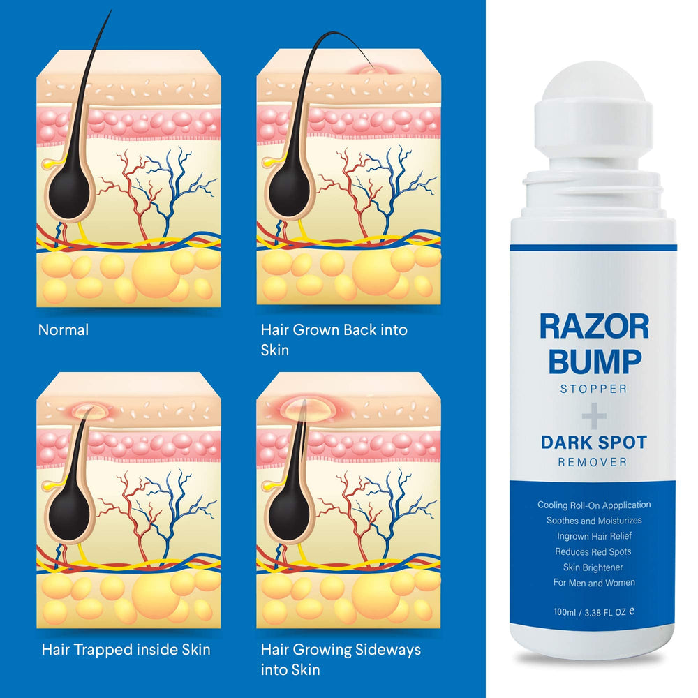 Sielkin Razor Bump Stopper featuring Avena Sativa Peptide for redness management.