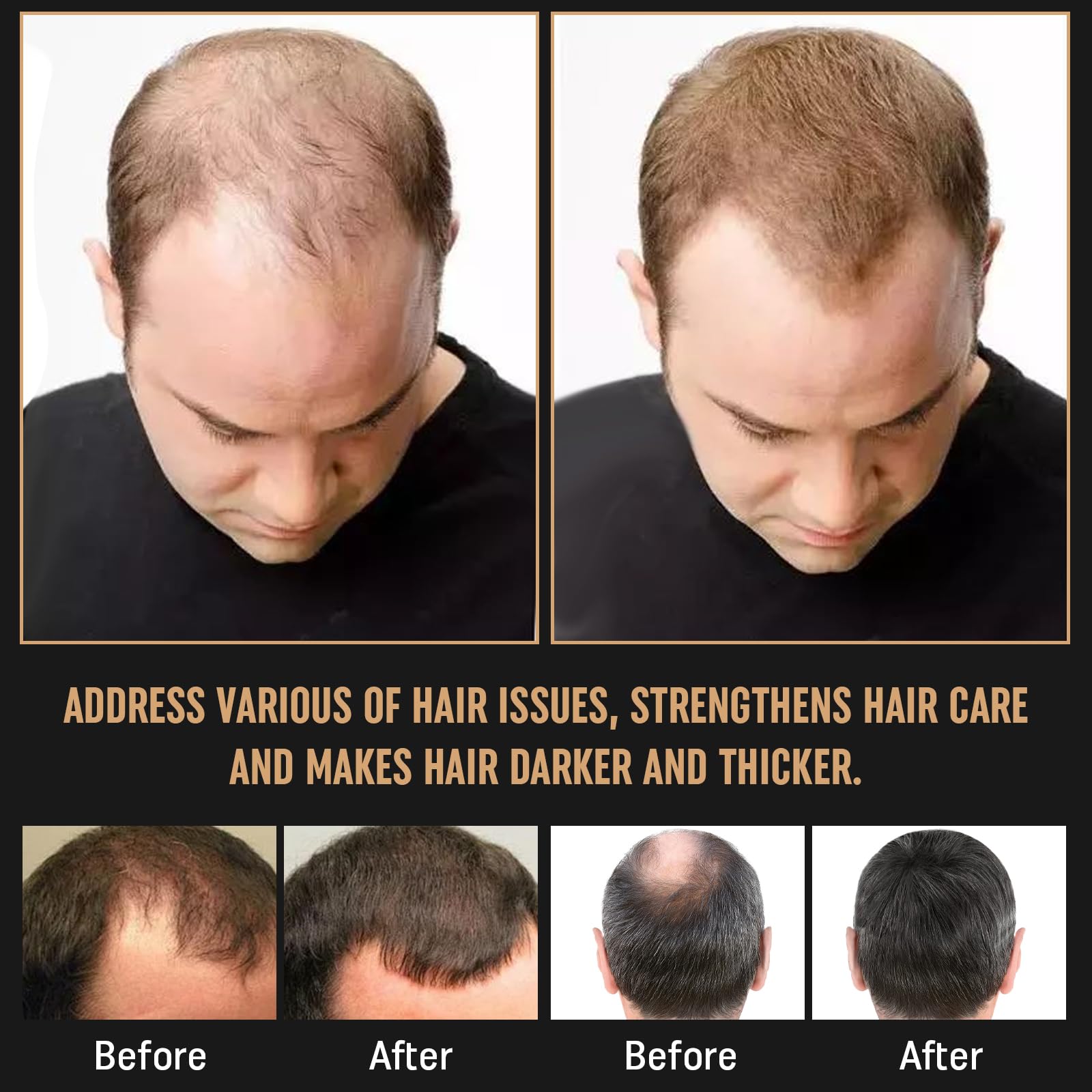 Simnoble Root Activator Shampoo daily shower use for all hair types.