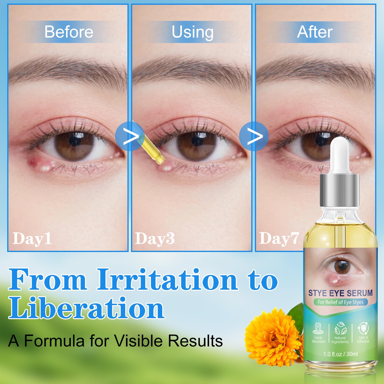 sinBron Eyelid Drops application provides calming relief on contact.
