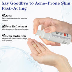 SINPIN AOBENZ Control Gel with hyaluronic acid provides gentle hydration.