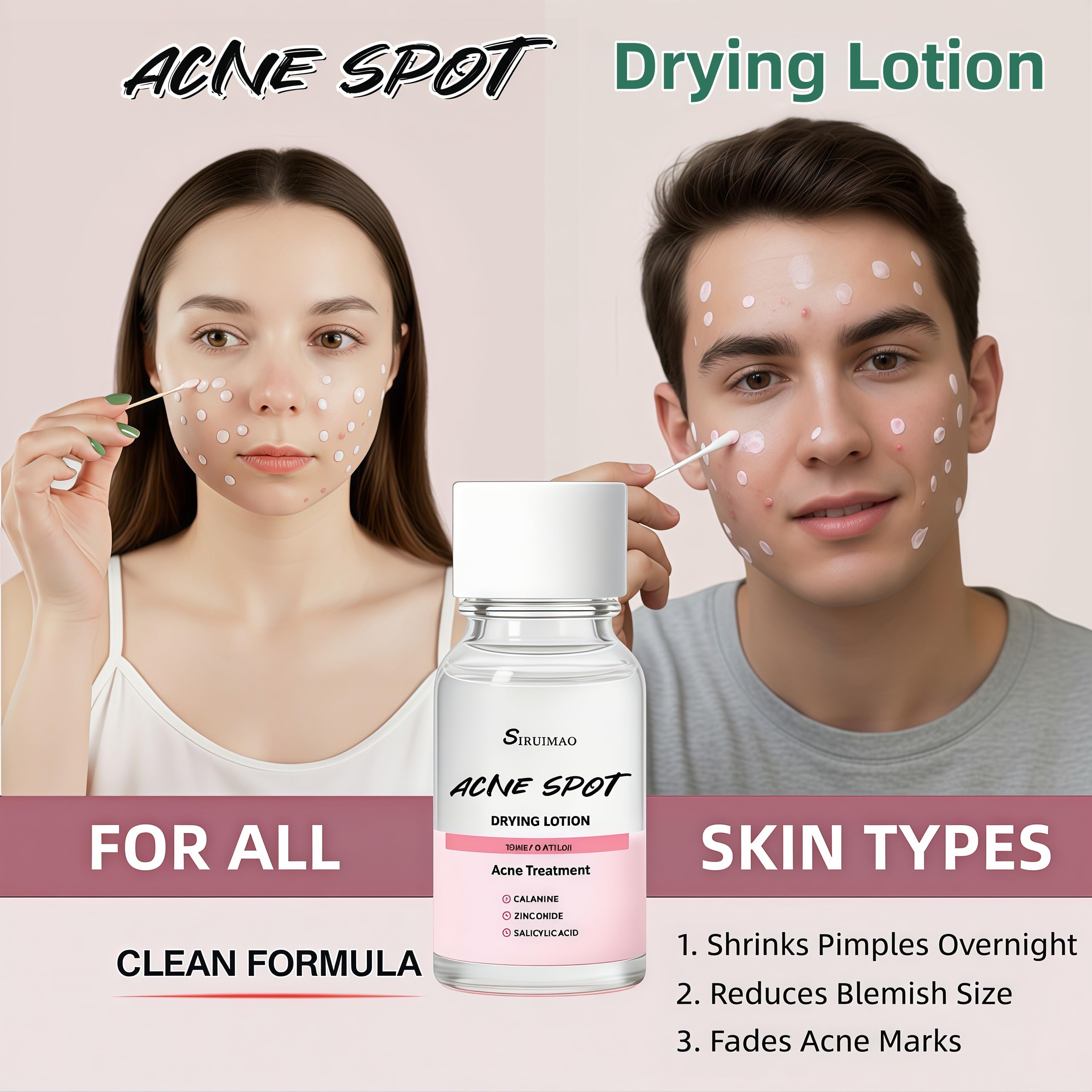 Siruimao drying lotion swab applying precise spot treatment.