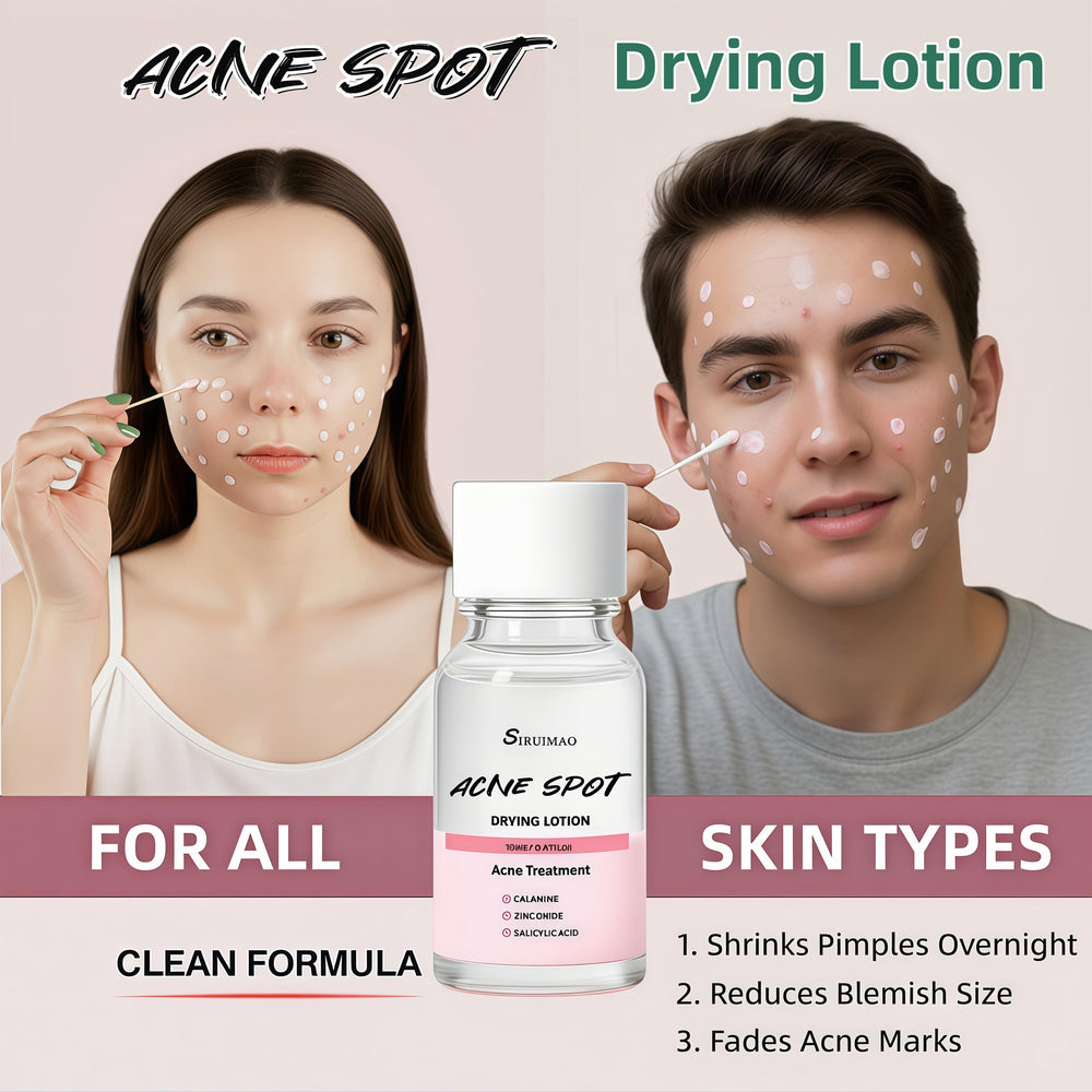 Siruimao drying lotion swab applying precise spot treatment.