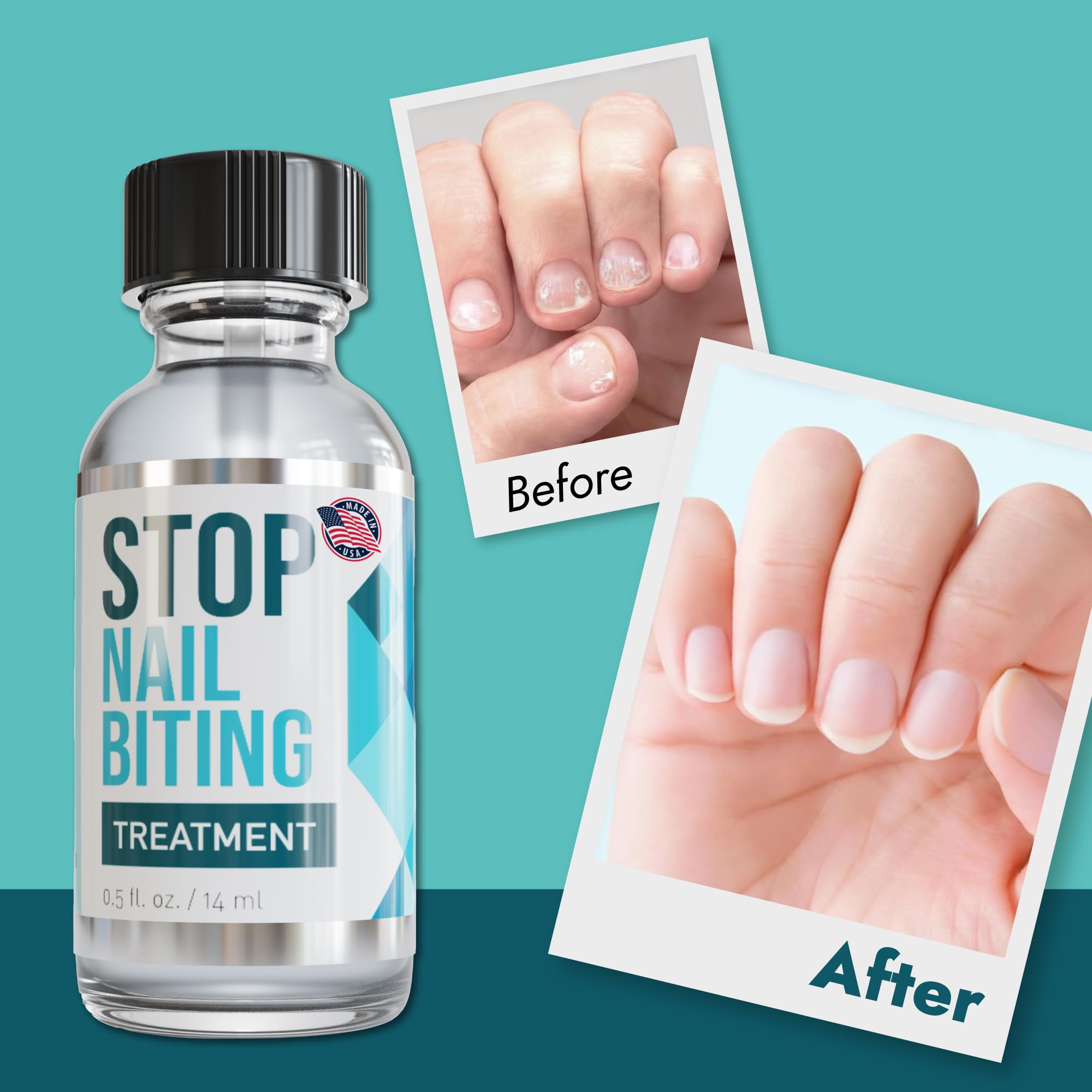 SISQUOC HEALTHCARE Stop Nail Biting daily wear for continuous nail care