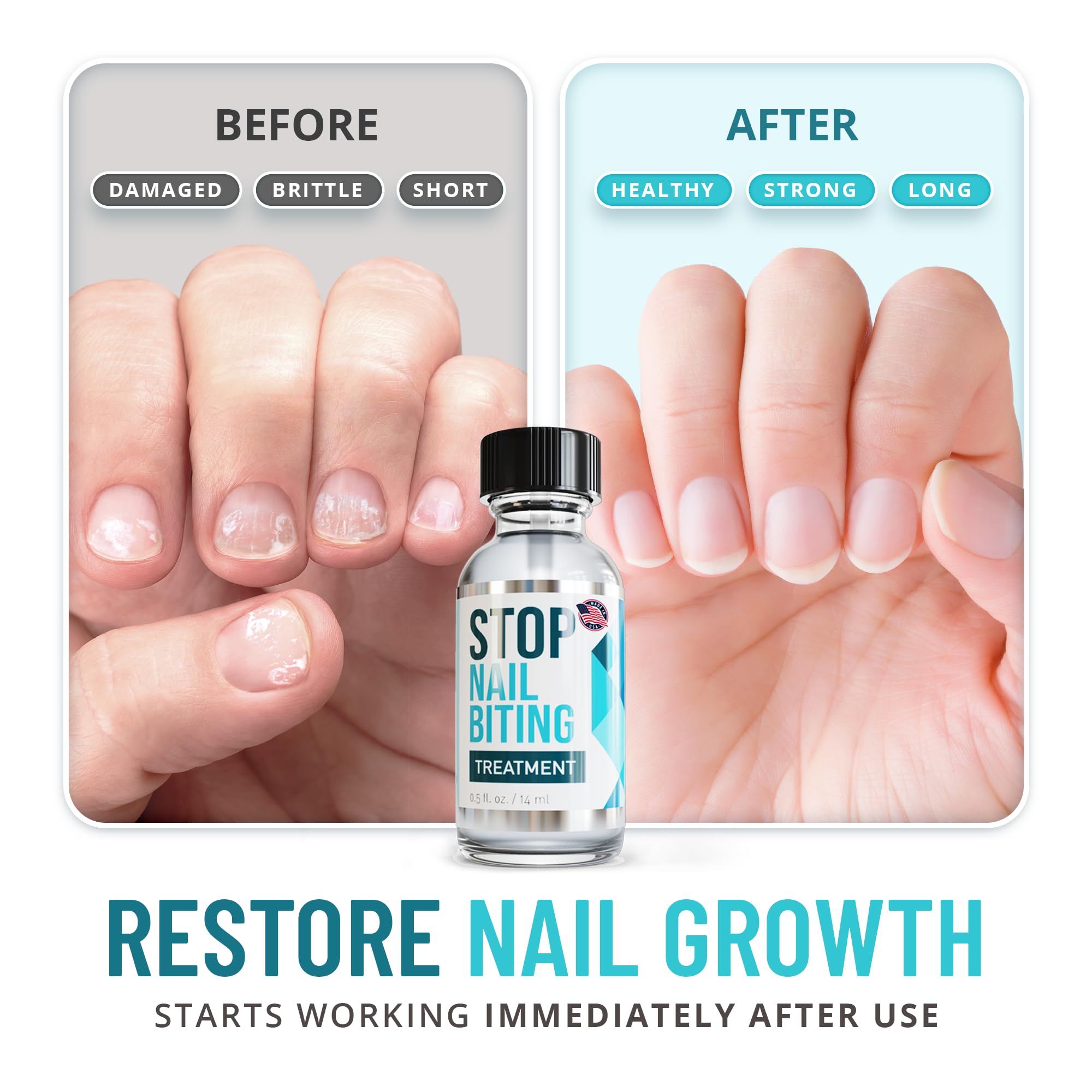 SISQUOC HEALTHCARE Stop Nail Biting kid use shows kid-friendly, safe deterrent polish.