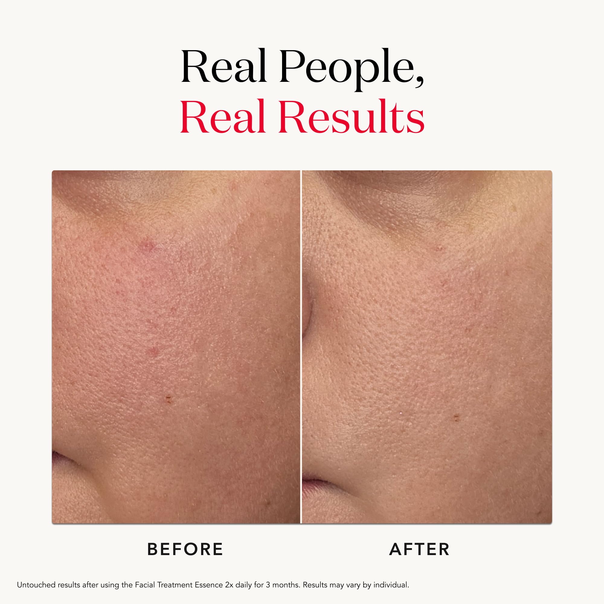 Gently pressed SK-II essence absorbs into skin for a smooth, radiant finish.