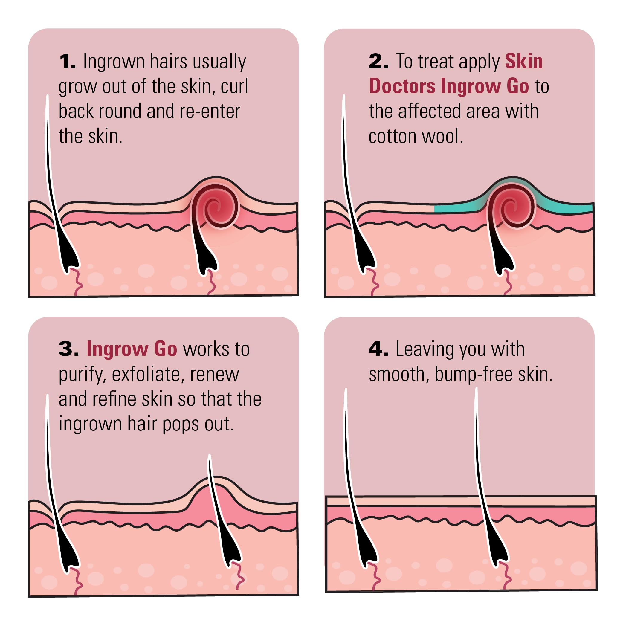 Skin Doctors Ingrow Go Lotion helping cleanse pores and release trapped hair