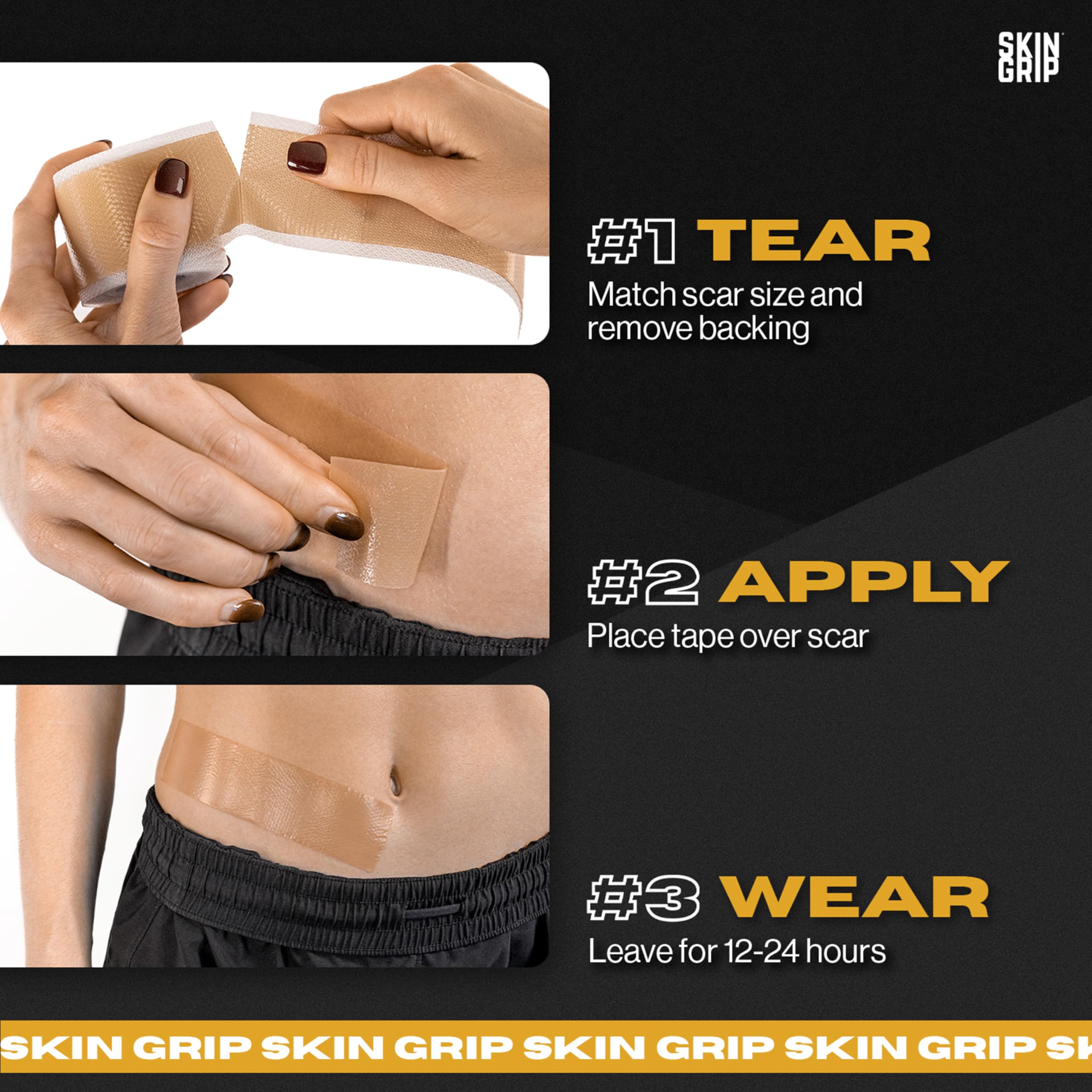 Skin Grip silicone tape on body for versatile scar care