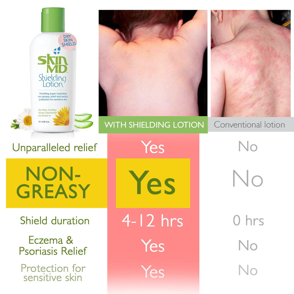 Skin MD Shielding body bottle demonstrates all-day moisture without clogging pores.