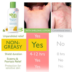 Skin MD Shielding body bottle demonstrates all-day moisture without clogging pores.