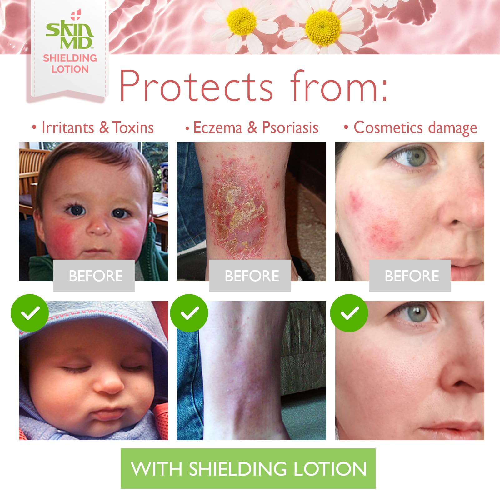 Skin MD Shielding ingredients list highlights natural botanicals for nourishment.