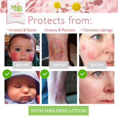 Packaging highlights eco-friendly production for Skin MD Shielding Lotion.