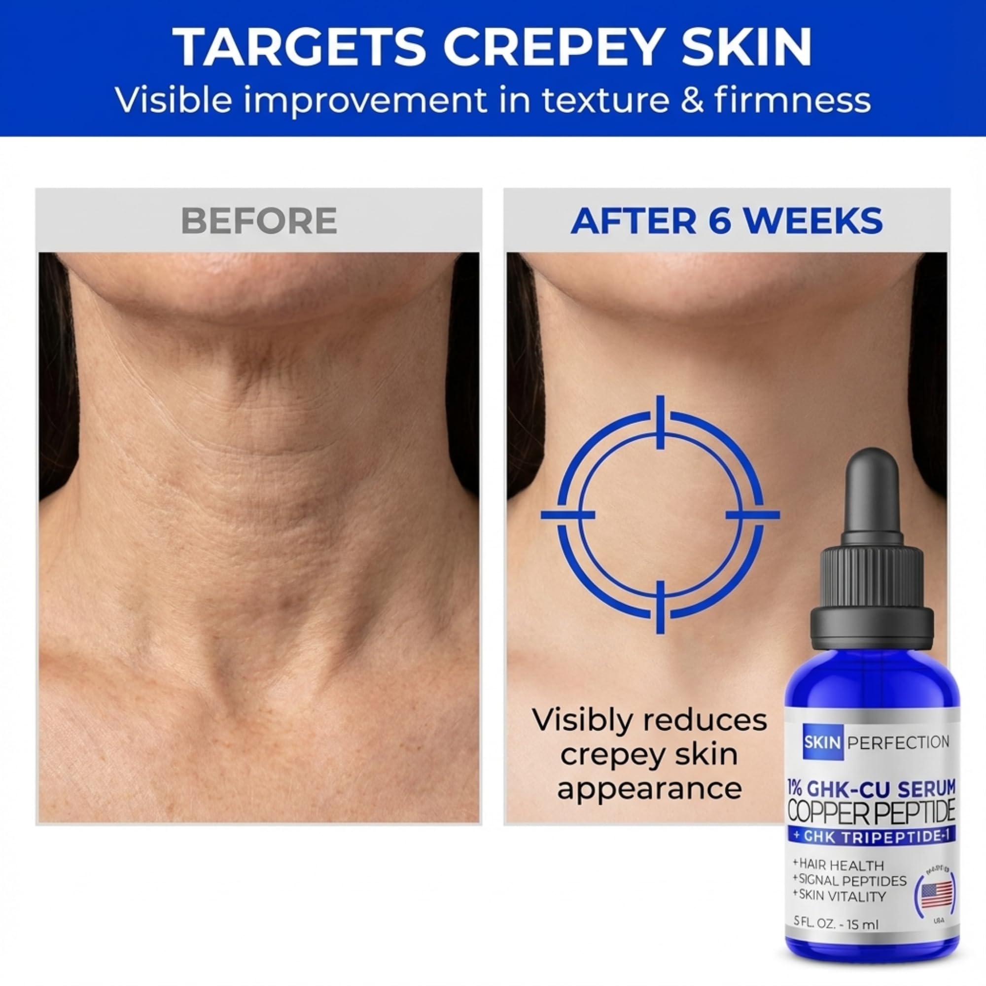 Neck application of Skin Perfection Copper Peptide Serum