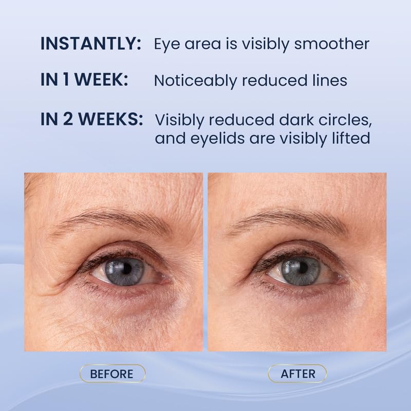 SKIN ULTIMA Dual Eye Cream retinol-peptide formula helps diminish fine lines.