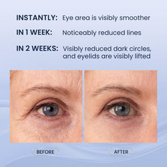 SKIN ULTIMA Dual Eye Cream retinol-peptide formula helps diminish fine lines.