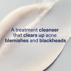 Foamy lather from Skinfix 2% BHA Cleanser during cleansing