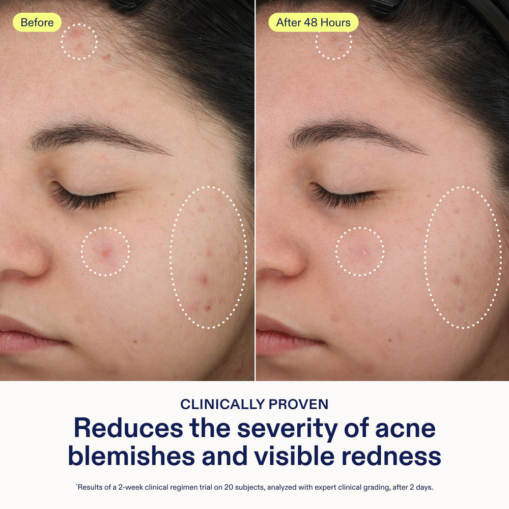 Skinfix clinical results graphic showing redness reduction and blemish improvement