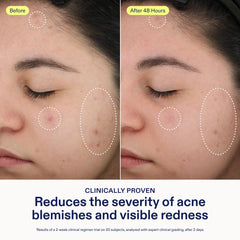 Skinfix clinical results graphic showing redness reduction and blemish improvement