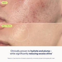 Skinfix Restoring Complex with niacinamide and peptides helps refine pores visually.