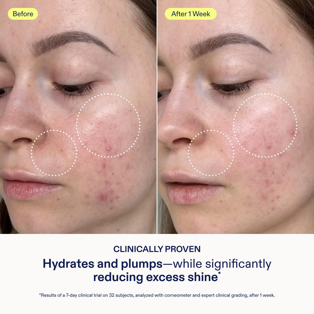 Skinfix Pore-Minimized closeup suggesting reduced pore visibility