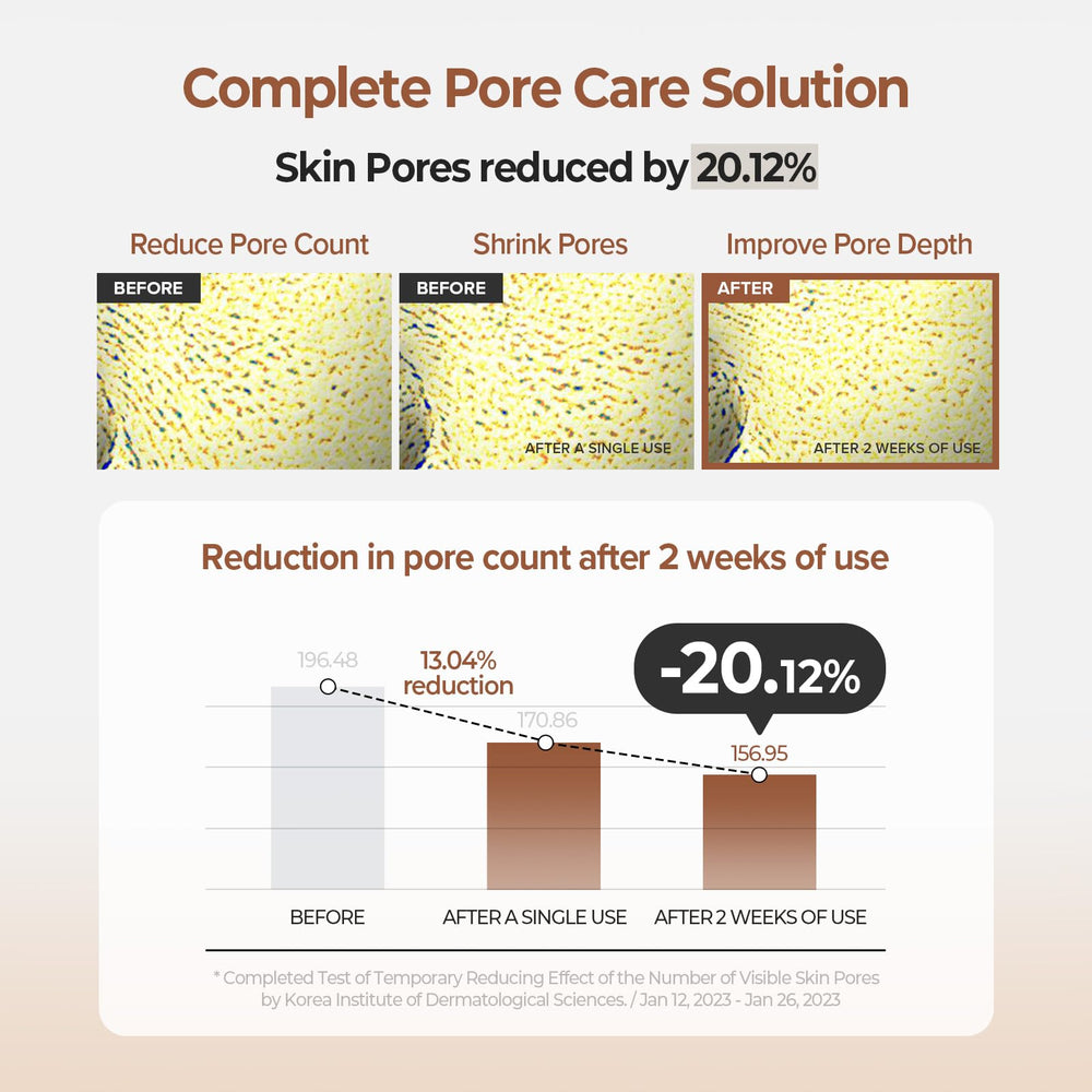 Applying SKINFOOD 1957 Acorn Pore Peptide Pad to refine pores