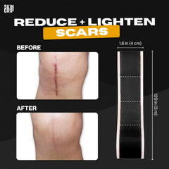 Skin Grip silicone tape cut to fit a surgical scar for discreet wear.