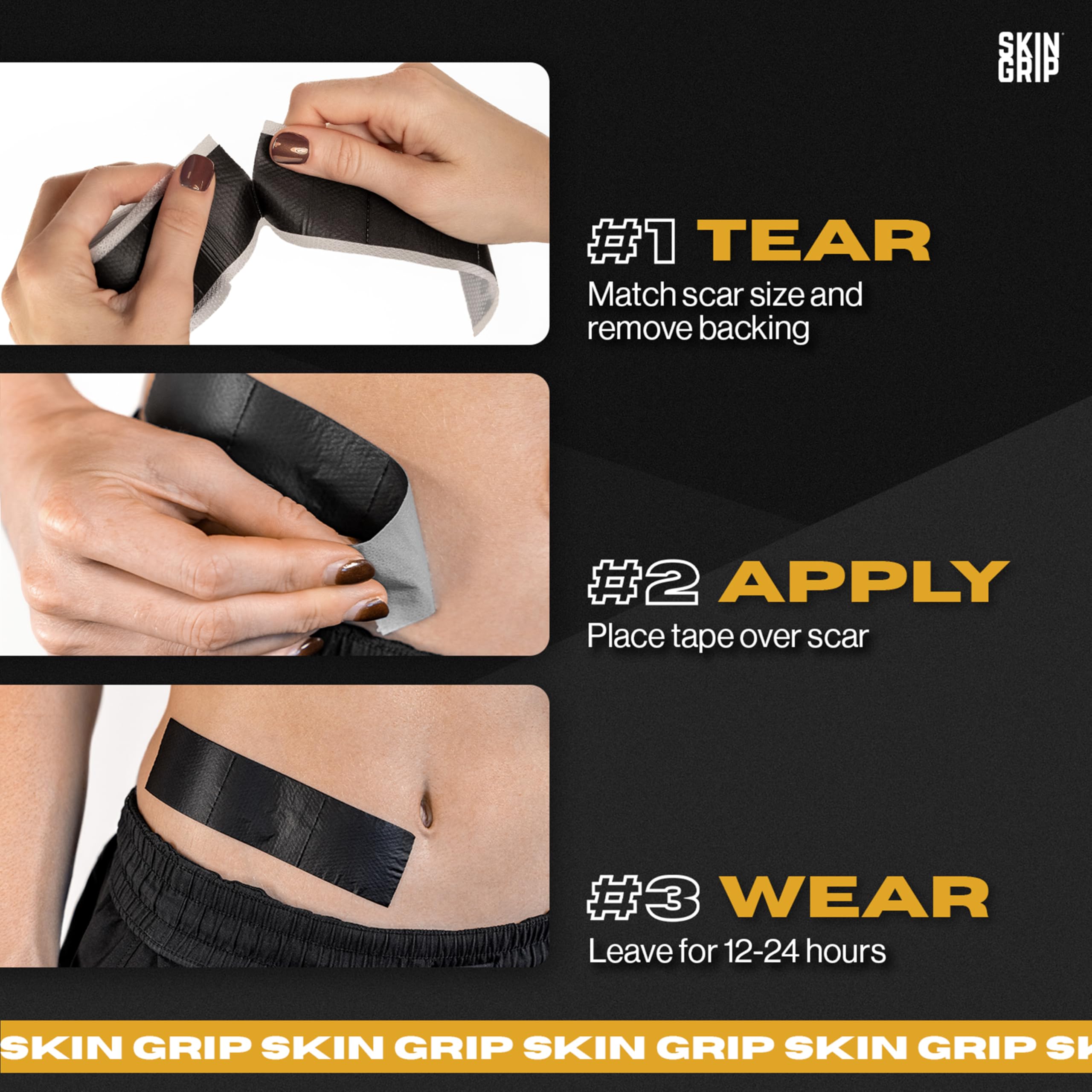 Skin Grip aids scar care around tummy tuck incisions with flexible adhesion.