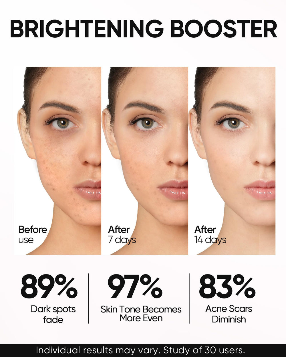 SKINTIFIC Ceramide close-up emphasizes barrier support and healthy-looking skin