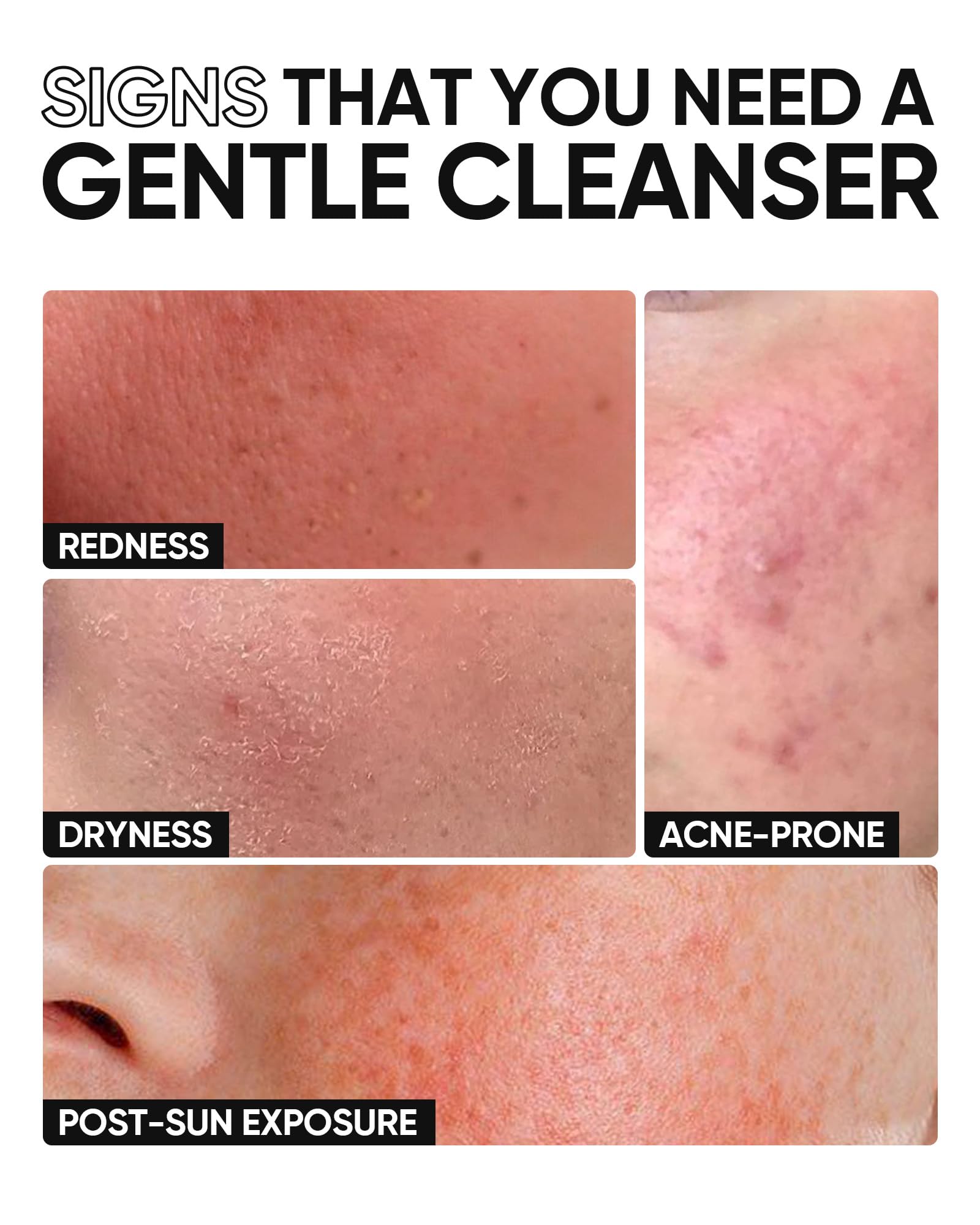 Soft foam texture of SKINTIFIC cleanser for gentle cleansing.