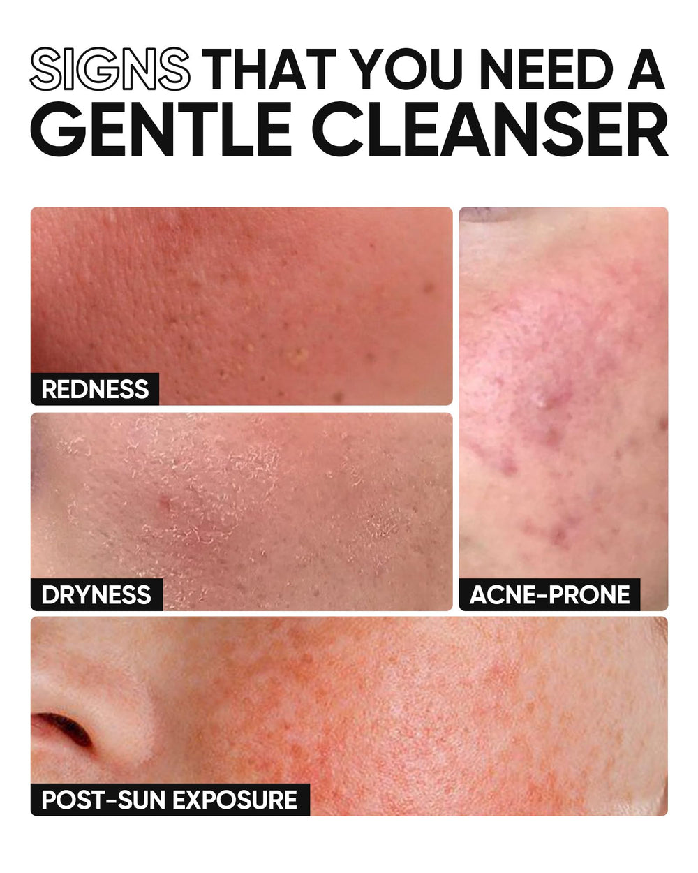 Soft foam texture of SKINTIFIC cleanser for gentle cleansing.